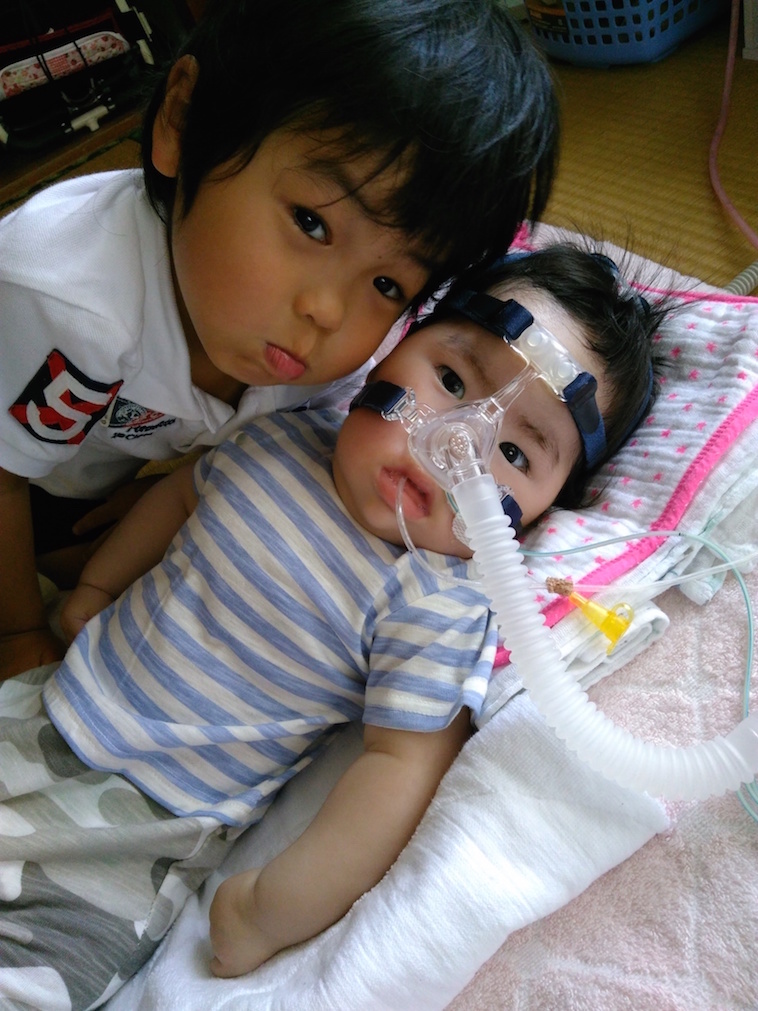 【写真】鼻マスクを装着して横になる弟と、弟に寄り添うお兄ちゃん