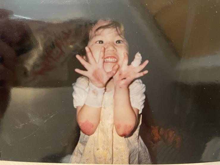 糖尿病性水疱の治療